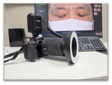 External Ocular Photography